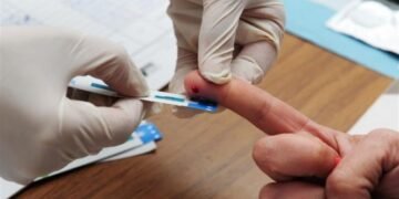Realizan test rápido de VIH y Sífilis en la UNCA