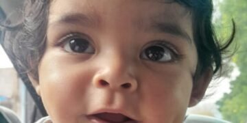 La familia de un pequeño catamarqueño pide ayuda urgente para costear una cirugía vital